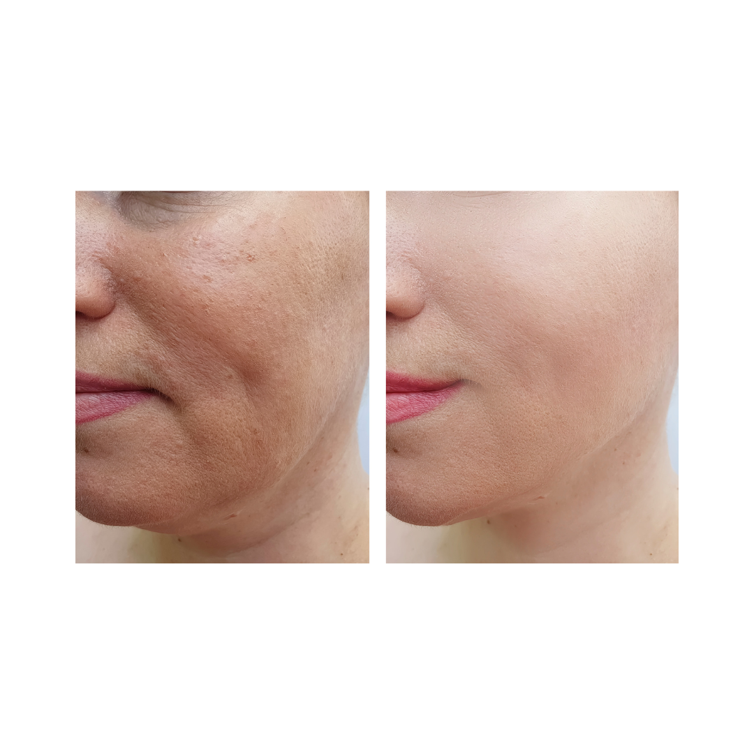 Snail Mucin Regenerating Serum by ZAIN1, Hydrating anti-aging serum with hyaluronic acid and Damascus rose, Moisturizing and rejuvenating facial serum