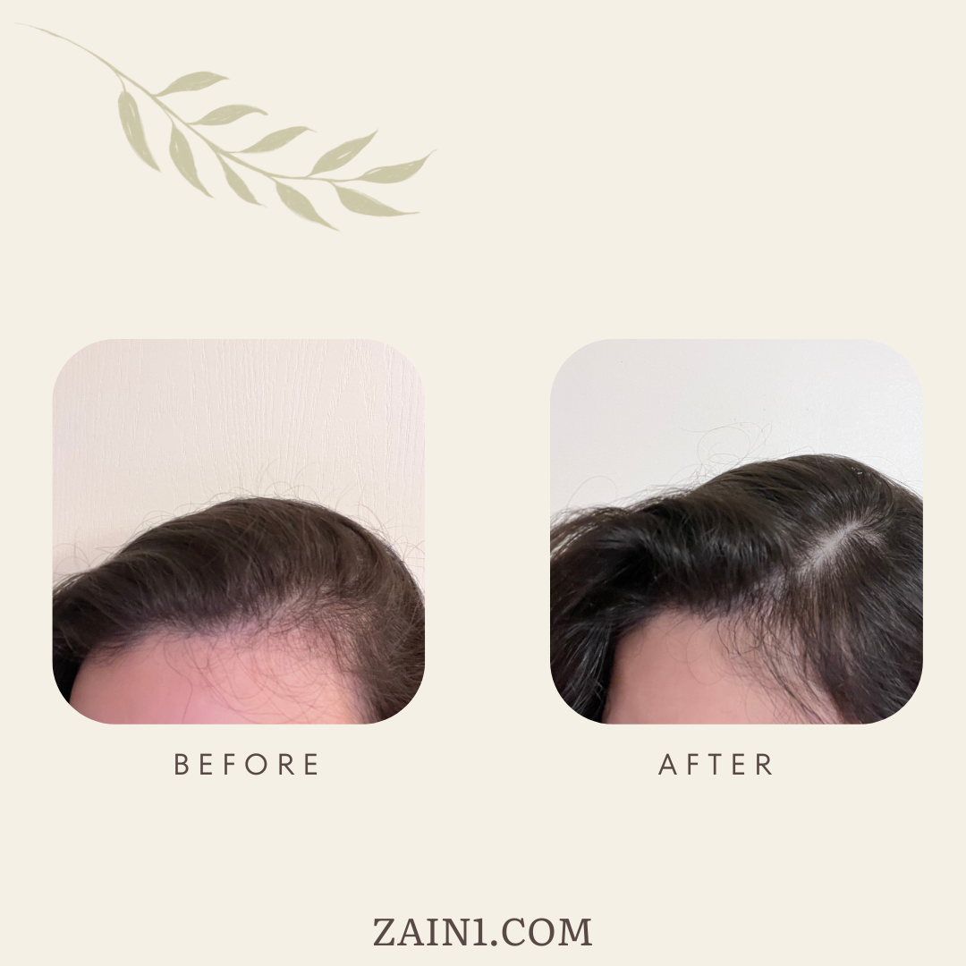 ZAIN1 Hair Growth Serum with Rosemary Essential Oil, Volumizing and strengthening hair serum, Color safe hair growth treatment